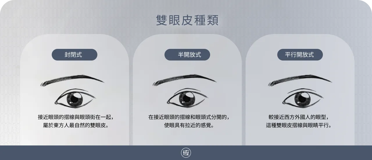 雙眼皮手術 | 客製化打造迷人眼型 自然風深邃雙眸 | 恆美學