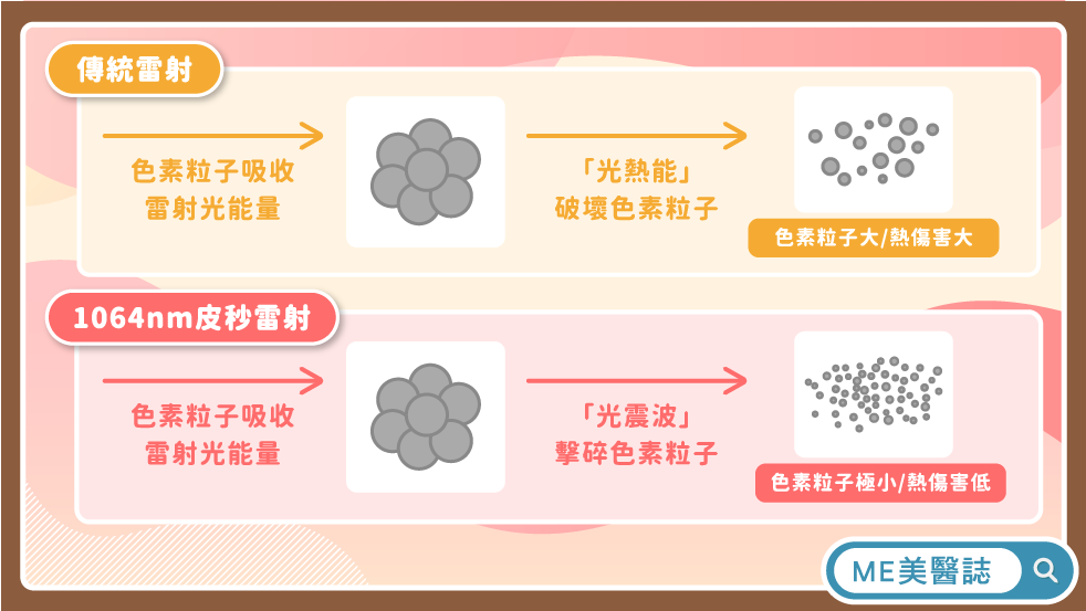 雷射術後保養怎麼做？別再只會說保濕防曬！雷射後沒做到「這件事」只是浪費錢？ | 恆美學