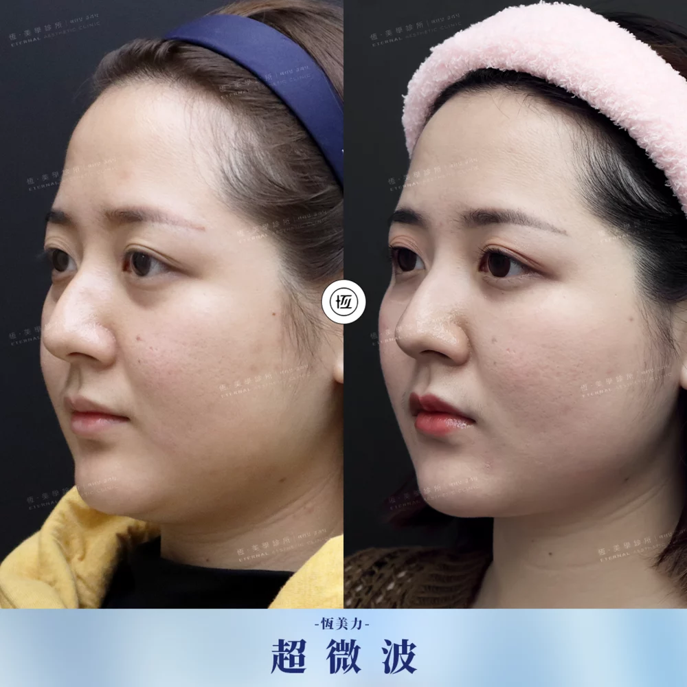 ONDA BA 20250819 1