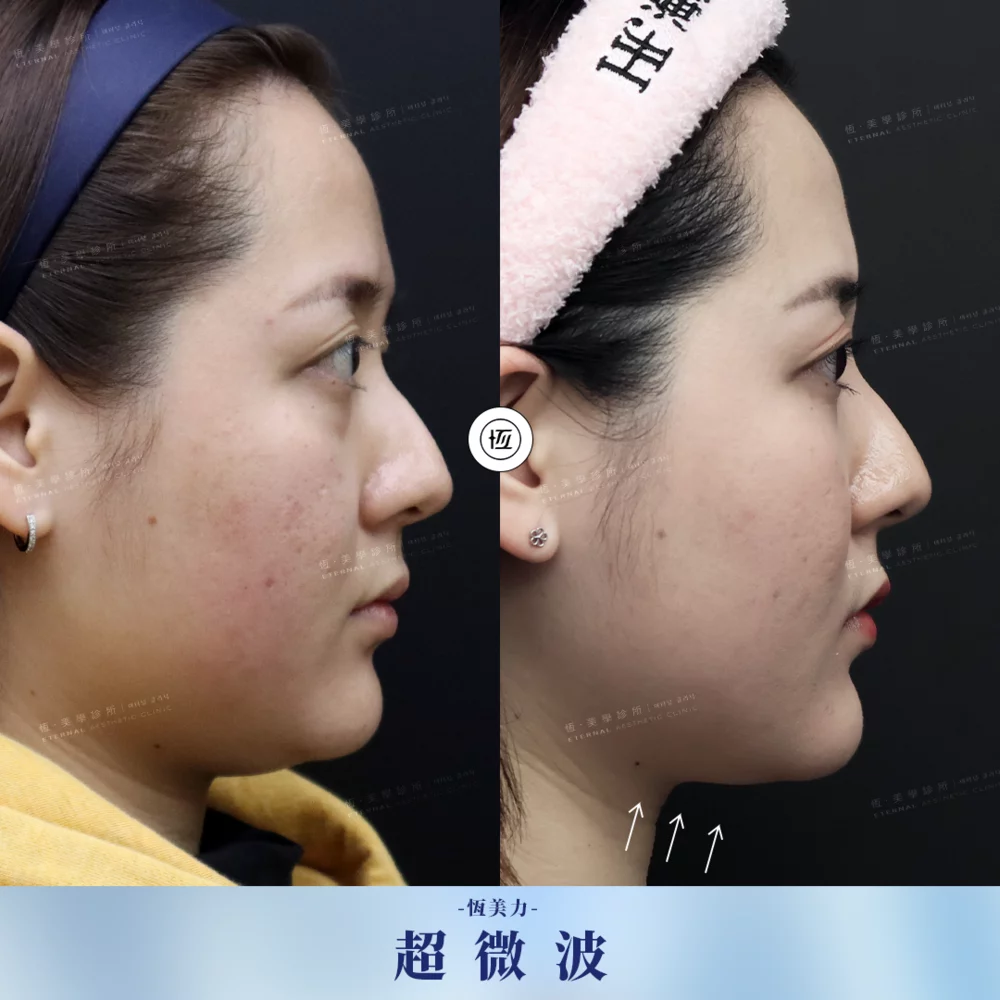 ONDA BA 20250819