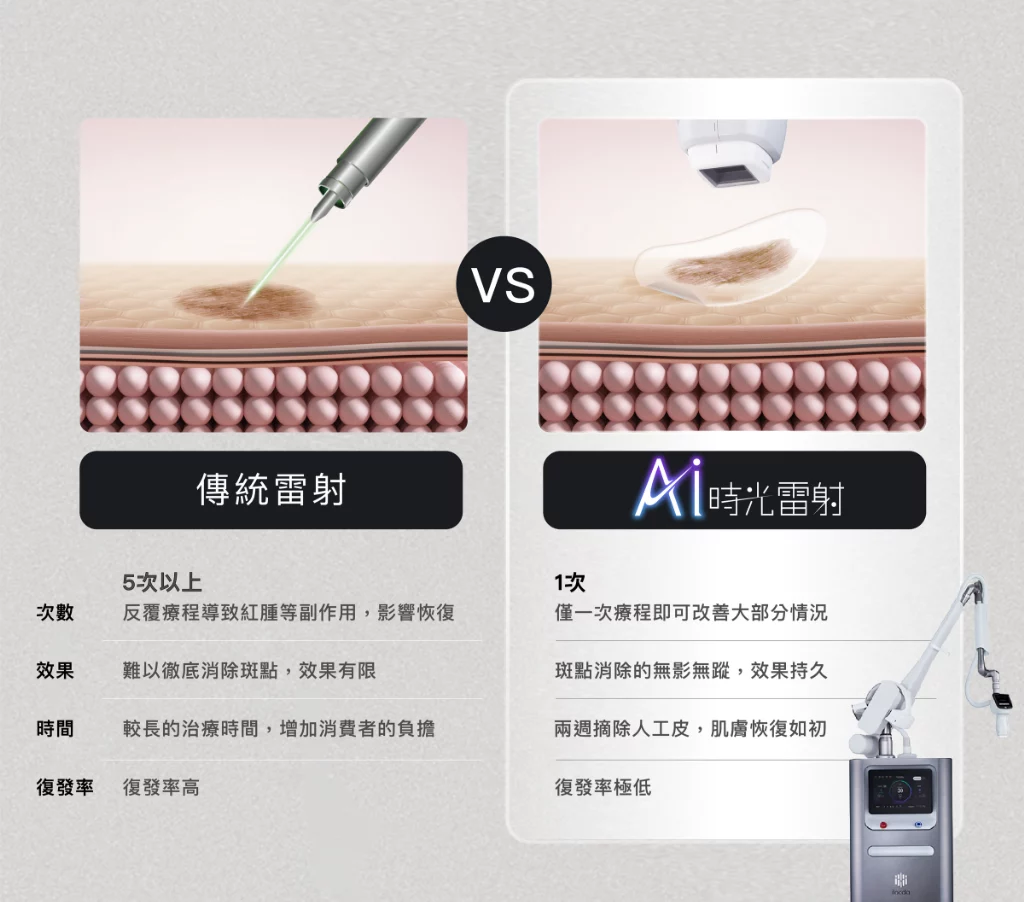 Reepot Ai 時光雷射 | 雷射差異 | 治療流程 | 恆美學