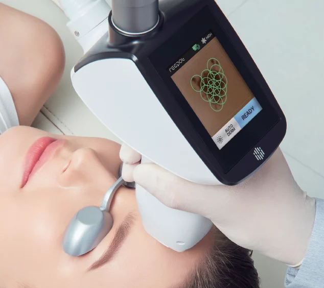 Reepot Ai 時光雷射 | 施作畫面ˇ | 去斑除斑 | 恆美學