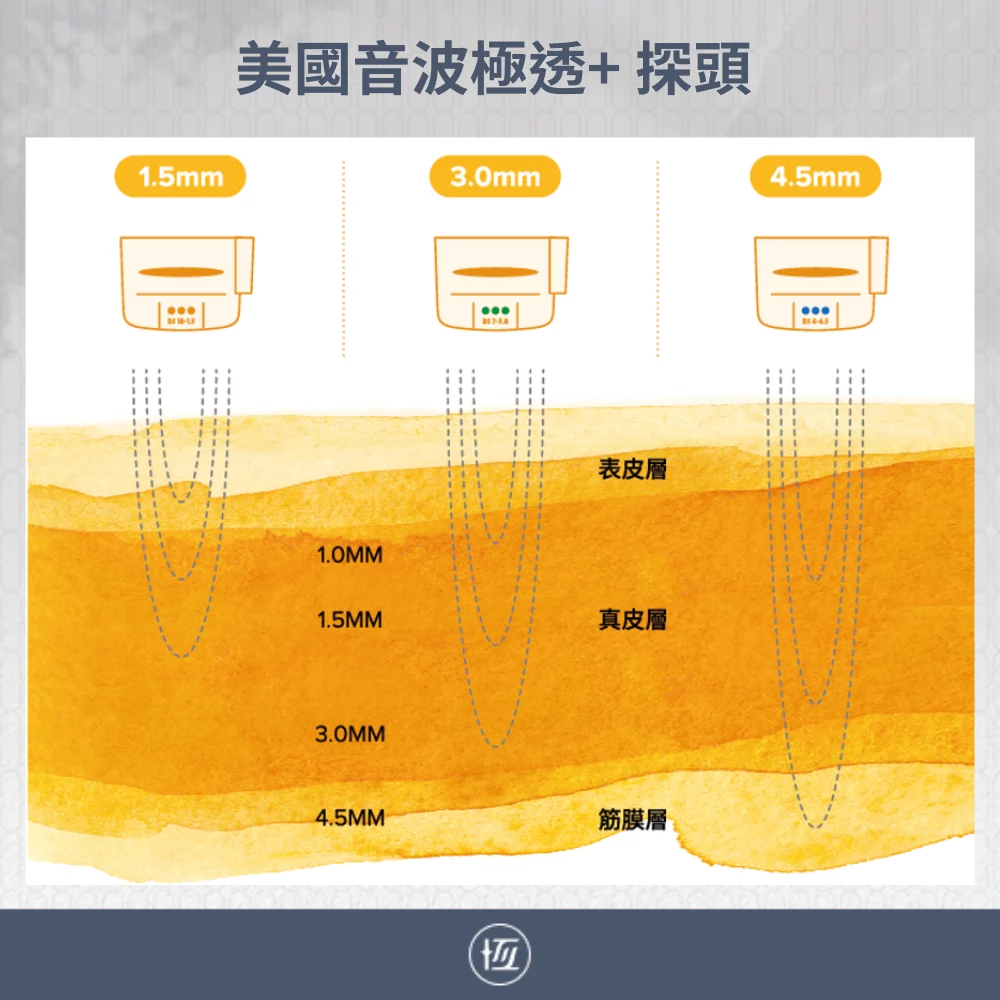 UltherapyPrime 20260130 1