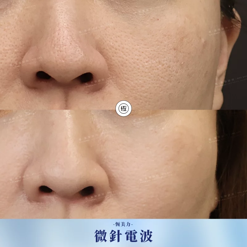 Sylfirmx BA 20260209