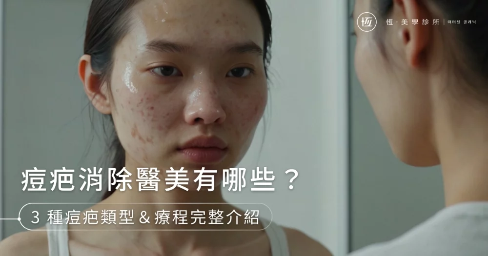 痘疤消除醫美有哪些?3種痘疤類型&5大適用療程完整介紹