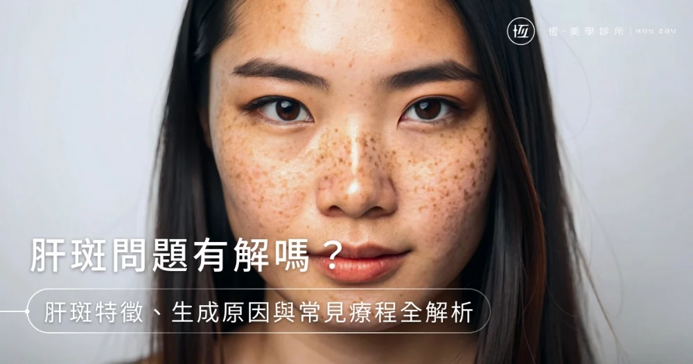 玻尿酸會饅化嗎?逆時針/喬雅登/保柔緹等常見玻尿酸特色一次看